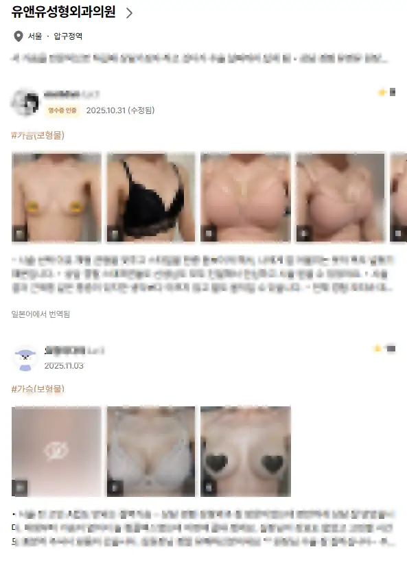Pembesaran payudara di Incheon: 2 hal yang perlu diketahui kalau Anda tidak ingin implan dilepas dalam 5 tahun — Gambar artikel 3