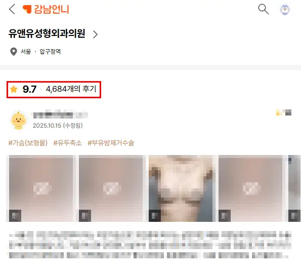 Operasi payudara di Gangnam? Sebaiknya dilakukan di mana. 〈Saran dari 20 Tahun Pengalaman Riset〉 — Gambar artikel 2
