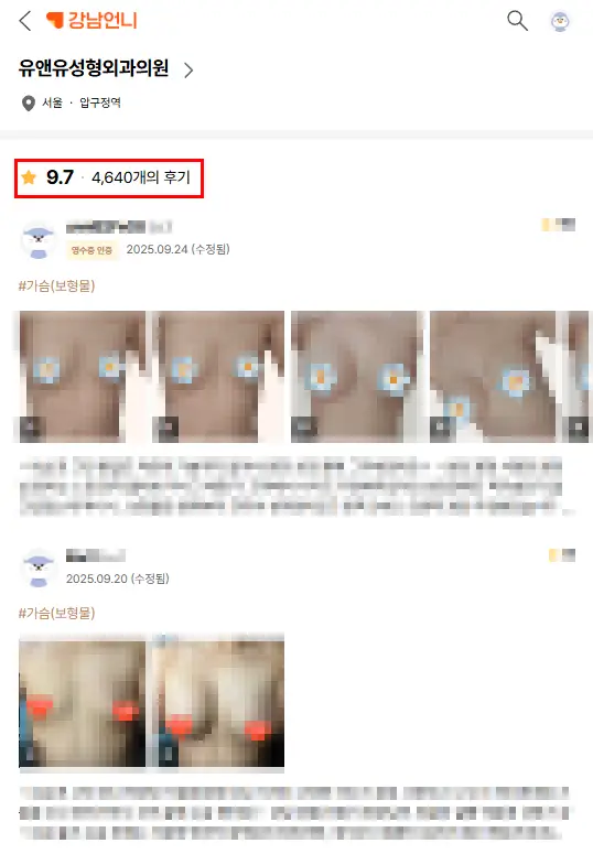 Implan Payudara Pecah: Apakah Harus Selalu MRI? Tidak Bisakah Diperiksa dengan USG? — Gambar artikel 2
