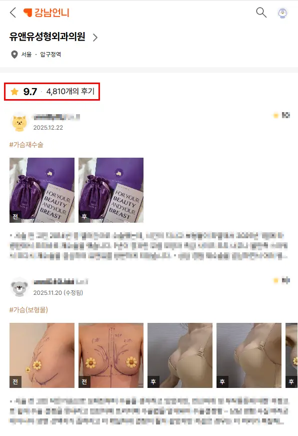 Operasi Payudara untuk Pectus Carinatum: Apakah Ukurannya Hanya Akan Membesar tanpa Belahan Payudara? <Saran Berdasarkan Pengalaman Riset 20 Tahun> — Gambar artikel 2
