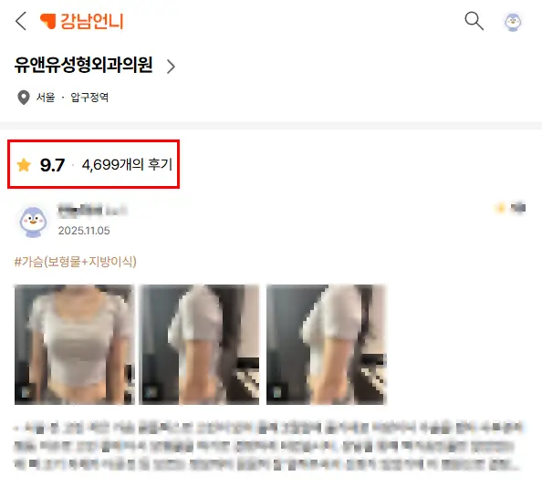 Pembesaran payudara di Incheon: 2 hal yang perlu diketahui kalau Anda tidak ingin implan dilepas dalam 5 tahun — Gambar artikel 2