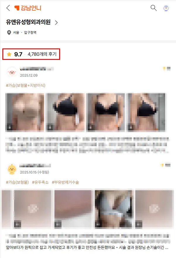 Rippling payudara: kalau gejalanya muncul, apa harus operasi ulang? (Saran dari 20 tahun riset) — Gambar artikel 3