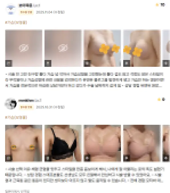 Klinik operasi payudara Apgujeong: salah kaprah bahwa ulasan dokter bedahnya sudah cukup — Gambar artikel 3