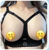 Tampilan sesaat setelah pembesaran payudara hanya dengan bra koreksi