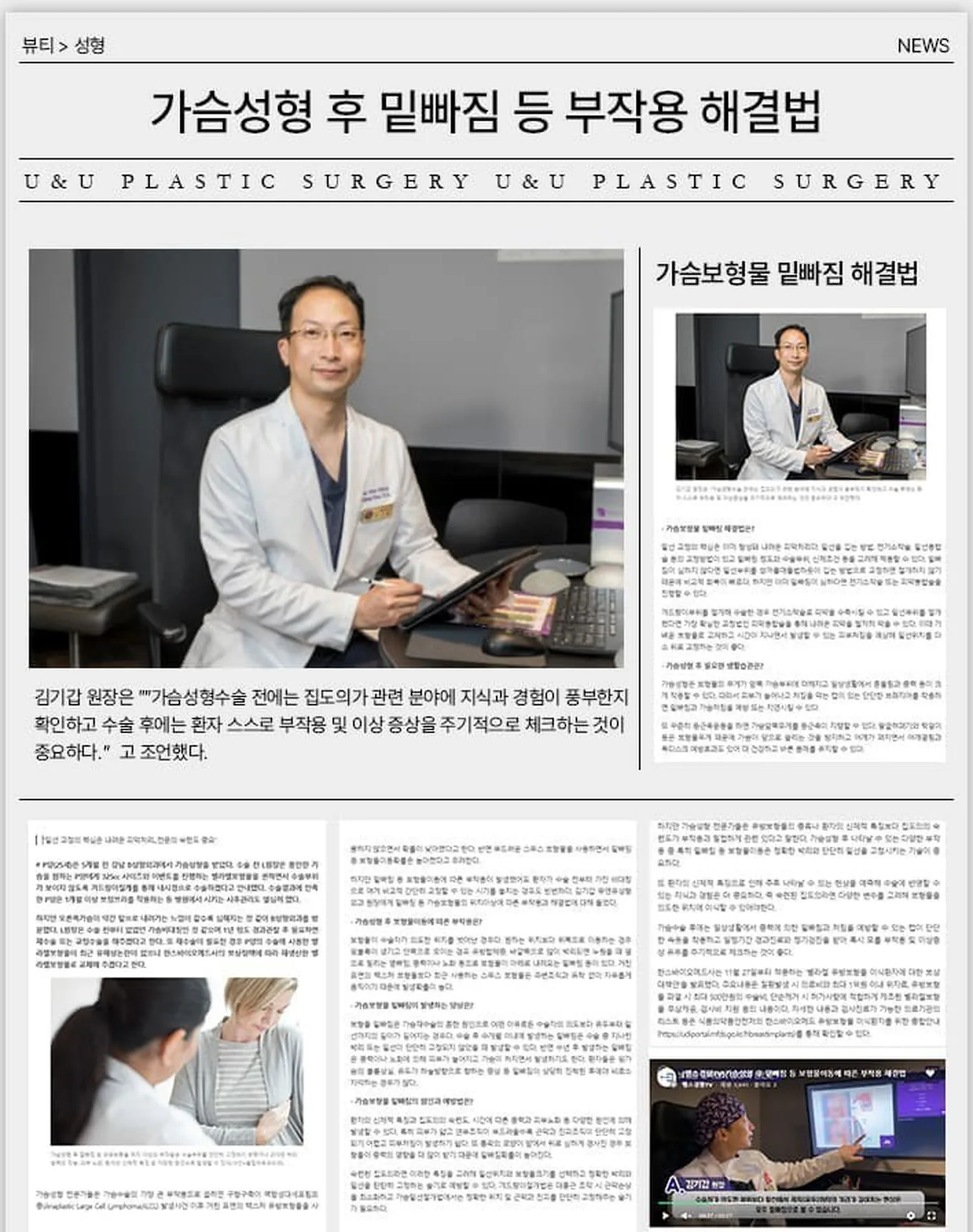 Halaman artikel media — ‘Cara menangani efek samping seperti implan turun setelah pembesaran payudara’. dr. Kim Ki-gap menyarankan, “Sebelum operasi pembesaran payudara, penting untuk memastikan bahwa dokter bedah memiliki pengetahuan dan pengalaman luas di bidang terkait, lalu setelah operasi, pasien perlu memeriksa sendiri secara berkala adanya efek samping dan gejala abnormal.”