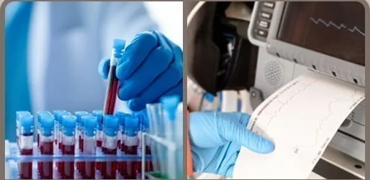 Pengambilan sampel darah dan lembar hasil pemeriksaan EKG