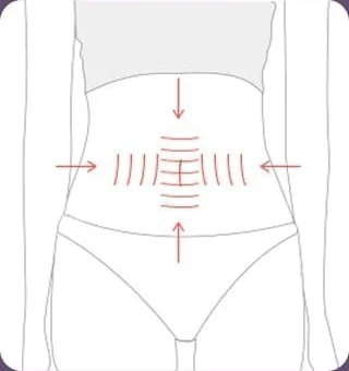 Ilustrasi pembentukan ganda otot perut secara horizontal dan vertikal setelah eksisi kulit kendur