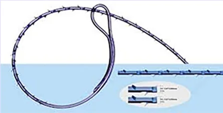 Diagram benang jahit V-Loc