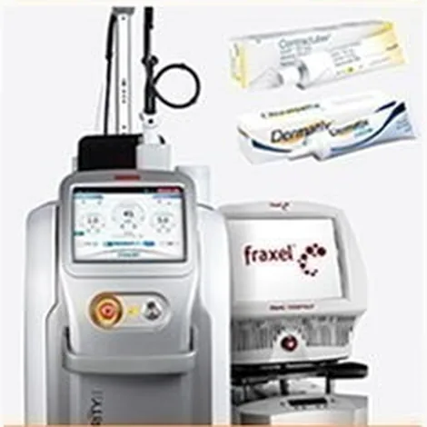 Peralatan laser bekas luka dan salep bekas luka