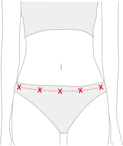 st4