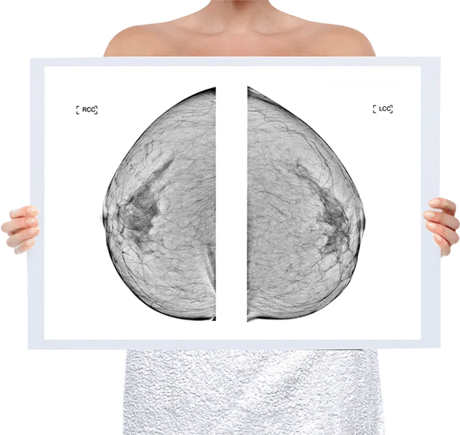 Healthy Breast Mamografi img5 m