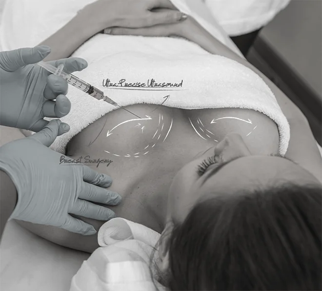 Healthy Breast Mammotome img1 1