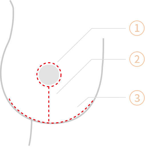 Payudara Kendur